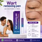 Eelhoe Wart Removing Pen In Pakistan image 2